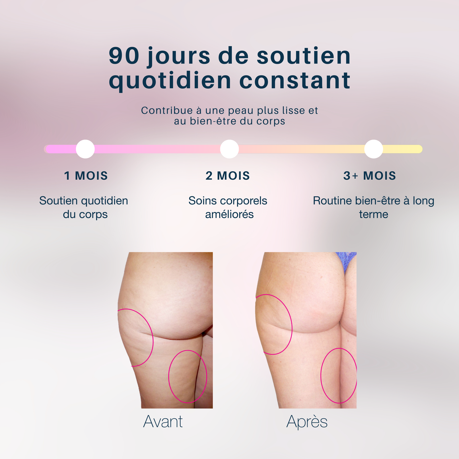 MyBodyContour