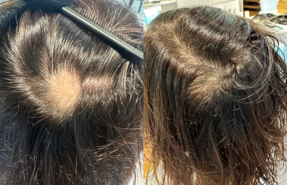 Bald spots & Targeted care - Before