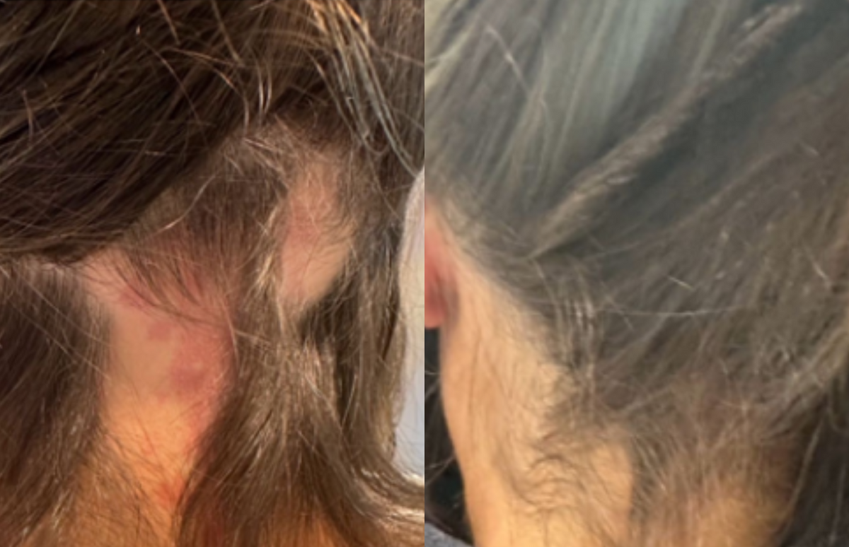 Neck & Targeted Care - Before